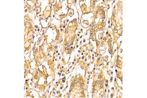 Immunohistochemistry of paraffin-embedded human stomach using BSG Antibody (ABIN5970747) at dilution of 1/100 (40x lens). (CD147 antibody)