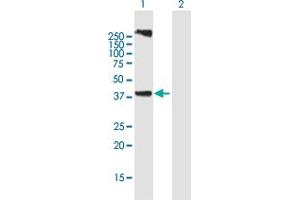 Western Blot analysis of LASS3 expression in transfected 293T cell line by LASS3 MaxPab polyclonal antibody. (LASS3 antibody  (AA 1-383))