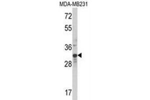 Western blot analysis of MLX Antibody (Center) in MDA-MB231 cell line lysates (35ug/lane). (MLX antibody  (Middle Region))