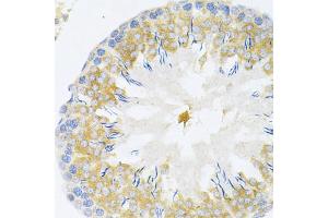 Immunohistochemistry of paraffin-embedded rat testis using TAPBP Antibody (ABIN1875423) at dilution of 1:200 (40x lens). (TAPBP antibody)