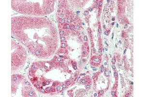 Anti-C25H / CH25H antibody IHC staining of human kidney. (CH25H antibody  (AA 190-239))