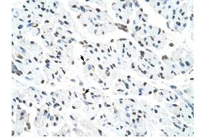 Matrin 3 antibody was used for immunohistochemistry at a concentration of 4-8 ug/ml to stain Skeletal muscle cells (arrows) in Human Muscle. (MATR3 antibody  (N-Term))