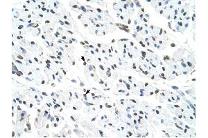 Matrin 3 antibody was used for immunohistochemistry at a concentration of 4-8 ug/ml to stain Skeletal muscle cells (arrows) in Human Muscle. (MATR3 antibody  (N-Term))