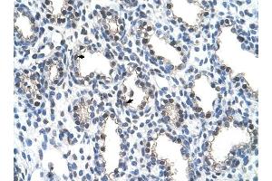 THOC4 antibody was used for immunohistochemistry at a concentration of 4-8 ug/ml to stain Alveolar cells (arrows) in Human Lung. (THO Complex 4 antibody  (N-Term))