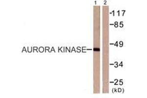 anti-Aurora Kinase (AA 256-305) antibody