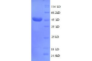 SDS-PAGE (SDS) image for CD320 Molecule (CD320) (AA 36-231), (partial) protein (GST tag) (ABIN1046799)