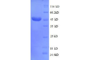CD320 Molecule (CD320) (AA 36-231), (partial) protein (GST tag) (CD320 Protein (AA 36-231, partial) (GST tag))