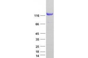 Validation with Western Blot