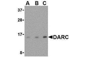 Western blot analysis of DARC in PC-3 cell lysate with AP30274PU-N DARC antibody at (A) 0. (DARC antibody  (N-Term))