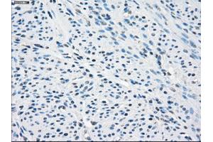Immunohistochemical staining of paraffin-embedded endometrium tissue using anti-SLC2A5mouse monoclonal antibody.