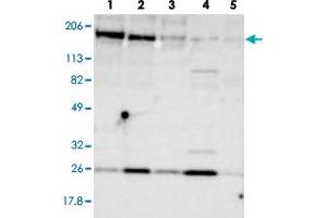 Western blot analysis of lane 1: RT-4, lane 2: U-251 MG, lane 3: A-431, lane 4: Liver and lane 5: Tonsil using ERBB2 polyclonal antibody . (ErbB2/Her2 antibody)