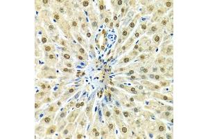 Immunohistochemistry (Paraffin-embedded Sections) (IHC (p)) image for anti-Heterogeneous Nuclear Ribonucleoprotein A2/B1 (HNRNPA2B1) (AA 1-180) antibody (ABIN3021593)
