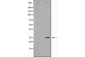 Western blot analysis of MCF7 cell lysate, using PRG2 Antibody. (PRG2 antibody  (Internal Region))