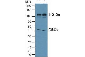 Figure. (MIB1 antibody  (AA 769-1000))