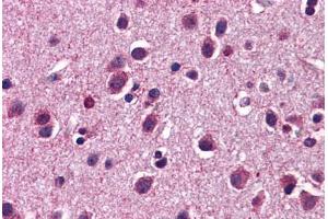Human Brain, Cortex: Formalin-Fixed, Paraffin-Embedded (FFPE) (HTR3C antibody  (AA 360-409))