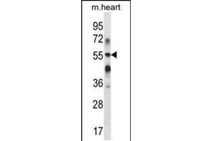 Western blot analysis in mouse heart tissue lysates (35ug/lane). (B3GALT2 antibody  (C-Term))