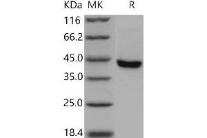 Western Blotting (WB) image for serpin Peptidase Inhibitor, Clade B (Ovalbumin), Member 8 (SERPINB8) protein (His tag) (ABIN7320362) (SERPINB8 Protein (His tag))