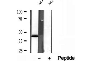 Western blot analysis of extracts of HeLa cells, using SPOP antibody.