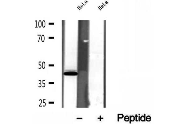 SPOP-B antibody  (Internal Region)