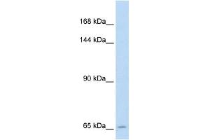 SLC19A1 antibody used at 5 ug/ml to detect target protein. (SLC19A1 antibody)