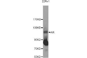 Western blot analysis of extracts of 22RV1 cells, using AR Antibody (ABIN5971084) at 1/500 dilution. (Androgen Receptor antibody)