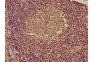 IHC image of ABIN7144464 diluted at 1:740 and staining in paraffin-embedded human lymph node tissue performed on a Leica BondTM system. (PYCARD antibody  (AA 1-195))