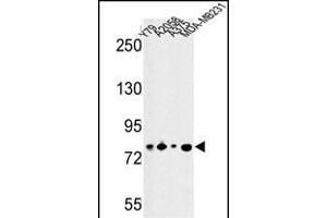 Western blot analysis of CSRP2BP Antibody (Center) (ABIN652812 and ABIN2842530) in Y79, , , MDA-M cell line lysates (35 μg/lane). (CSRP2BP antibody  (AA 246-275))