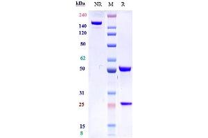 Anti-IL-7Ra / CD127 Reference Antibody (lusvertikimab) on SDS-PAGE under reducing (R) condition. (Recombinant IL7RA (Lusvertikimab Biosimilar) antibody)