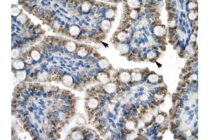 C20ORF100 antibody was used for immunohistochemistry at a concentration of 4-8 ug/ml to stain Epithelial cells of intestinal villus (arrows) in Human Intestine.