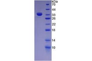 Image no. 1 for Fibronectin (AA 313-607) (Active) protein (His tag) (ABIN6239891)