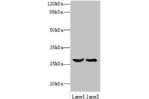 Western blot All lanes: OCIAD1 antibody at 1 μg/mL Lane 1: Mouse liver tissue Lane 2: Mouse kidney tissue Secondary Goat polyclonal to rabbit IgG at 1/10000 dilution Predicted band size: 28, 21, 22 kDa Observed band size: 28 kDa (OCIAD1 antibody  (AA 1-245))