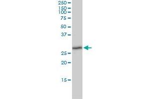 TXNDC9 monoclonal antibody (M02), clone 1E8-7C12 Western Blot analysis of TXNDC9 expression in K-562 . (TXNDC9 antibody  (AA 1-226))