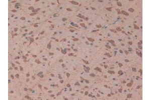 IHC-P analysis of Mouse Brain Tissue, with DAB staining. (TOLLIP antibody  (AA 19-254))