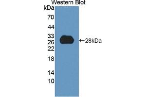 Detection of Recombinant HDLBP, Human using Polyclonal Antibody to High Density Lipoprotein Binding Protein (HDLBP) (HDLBP antibody  (AA 158-371))