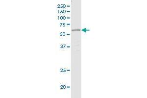 OTOP1 monoclonal antibody (M02), clone 5E3. (Otopetrin 1 antibody  (AA 415-504))