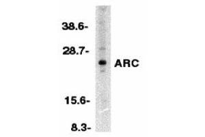 Western Blotting (WB) image for anti-ARC (N-Term) antibody (ABIN1031239) (ARC (N-Term) antibody)