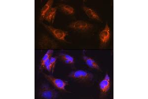 Immunofluorescence analysis of U-251MG cells using  Rabbit pAb (ABIN6131182, ABIN6136830, ABIN6136831 and ABIN6222940) at dilution of 1:100 (40x lens).