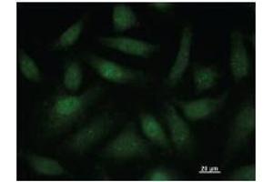 Immunostaining analysis in HeLa cells. (SATB1 antibody)