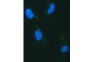 IF analysis of YKL-40/CHI3L1 using anti-YKL-40/CHI3L1 antibody (ABIN7599648). (CHI3L1 antibody  (AA 103-383))