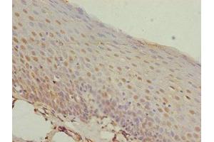 Immunohistochemistry of paraffin-embedded human tonsil tissue using ABIN7155798 at dilution of 1:100 (MEOX1 antibody  (AA 1-254))