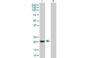 Western Blot analysis of MGMT expression in transfected 293T cell line by MGMT MaxPab polyclonal antibody. (MGMT antibody  (AA 1-207))