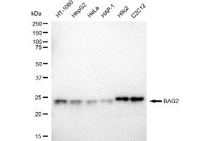 Western blotting analysis using BAG2 antibody (ABIN7797745).