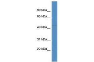 Image no. 1 for anti-F-Box and Leucine-Rich Repeat Protein 20 (FBXL20) (AA 176-225) antibody (ABIN6746893) (FBXL20 antibody  (AA 176-225))