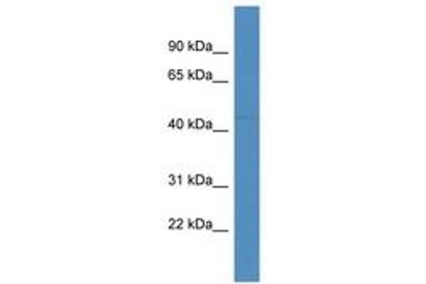 FBXL20 antibody  (AA 176-225)