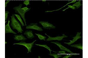 Immunofluorescence of monoclonal antibody to NDN on HeLa cell. (NDN antibody  (AA 222-321))