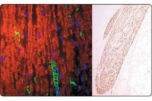 In the Left panel (a tissue section through an adult sciatic nerve), Po (green staining) can be seen in the myelin and Schwann cell processes surrounding the nodes of Ranvier. (MPZ antibody)