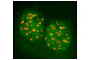 FANCD2 antibody  (N-Term)