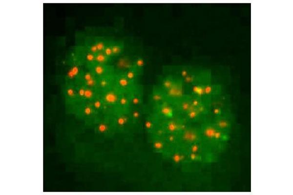 FANCD2 antibody  (N-Term)