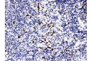 MMP-9 was detected in paraffin-embedded sections of mouse spleen tissues using rabbit anti- MMP-9 Antigen Affinity purified polyclonal antibody (Catalog # ) at 1 ? (MMP 9 antibody  (C-Term))