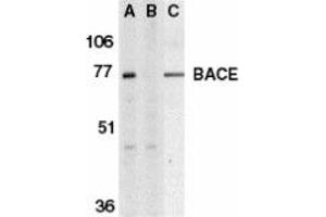 Image no. 1 for anti-Beta-secretase 1 (BACE1) (C-Term) antibody (ABIN204488) (BACE1 antibody  (C-Term))